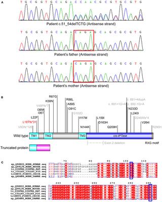 Case Report: Clinical Features of a Chinese Boy With Epileptic Seizures and Intellectual Disabilities Who Carries a Truncated NUS1 Variant